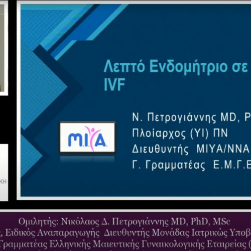 Λεπτό ενδομήτριο σε κύκλους εξωσωματικής γονιμοποίησης